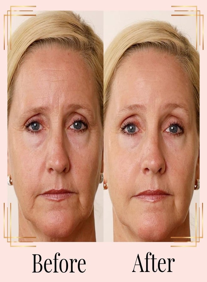 Nakery Retinol Eye Cream - Anti Wrinkle Face Cream with Hyaluronic Acid Face Tightening Serum - Wrinkle Cream for Under Eye - Instant Wrinkle Remover Serum 50ml - Image 2